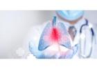 Expert Care for Lung Cancer Singapore Patients