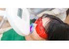 Brighten Your Smile with Trusted Teeth Whitening Dentist Singapore