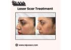 Expert Laser Scar Treatment in Newport Beach
