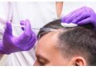Exosomes Hair Therapy in Islamabad