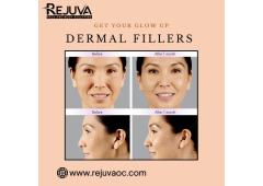 Dermal Fillers in Newport Beach Dermal Fillers in Newport Beach