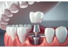 Professional Orthodontics Melbourne – Straighten Your Smile with Confidence