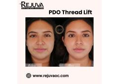 PDO Thread Lift Newport Beach PDO Thread Lift Newport Beach