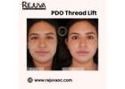 PDO Thread Lift Newport Beach