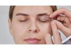 Eyelid Surgery in Islamabad