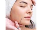 Facial Thread Lifting in Bengaluru Near Me | ZIUR Wellness