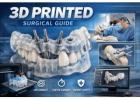 India-Based Experts in 3D Printed Medical Implants and Custom Solutions