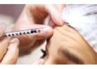 Skin Clinic Skin Tag Removal – Gentle and Expert Care in London