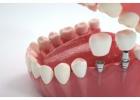 Dental Implants in Northeast Philadelphia for Long Lasting Natural Looking Smiles