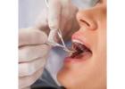 Affordable General Dentist for Routine Dental Checkups in