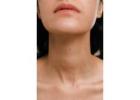 Neck Lift Surgery For A Defined Youthful Neckline