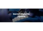Dental implants Tijuana offers natural-looking and durable teeth replacements