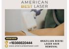 Brazilian Bikini Laser Hair Removal Austin, Texas – Pain-Free & Effective Hair Removal