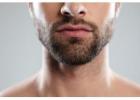 Advanced Hairline & Beard Restoration in Beverly Hills
