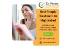Specialized Acne Clinic In Hyderabad | Dr. Venus