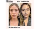 PDO Thread Lift Newport Beach