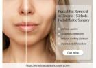 Buccal Fat Removal in Ontario | Nichols Facial Plastic Surgery