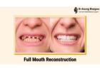 Best Full Mouth Rehabilitation for Lasting Results | Dr. Anurag Bhargava