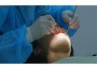 Reliable St Louis Urgent Dental Care Solutions for Fast Pain Relief and Same Day Treatment