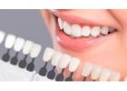 Porcelain Veneers with Durable and Natural Results