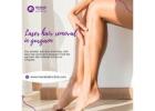 Affordable Laser Hair Removal in Gurgaon – Get Smooth Skin Today