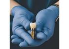 Siiodentimplants innovation in dental implants for professionals
