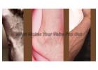 What Makes Your Veins Pop Out: Understanding Visible Veins