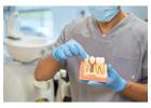 Dental implants Tijuana offers natural-looking and durable teeth replacements