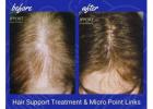 Supporting Hair Regrowth After Chemotherapy with Care and Comfort