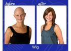 Hair Solutions for Hair Loss After Chemo Treatment