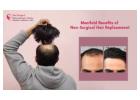 Discover the Best Non-Surgical Hair Replacement Solutions for Natural Results