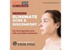 Hair Transplant Treatment in india