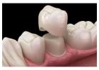 Dental Clinic in Vijayawada | Best Dental Hospital in Vijayawada | Dentists in Vijayawada -  Andhra