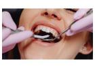 Smilora Dental Clinic – Expert Dental Services