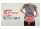 Laparoscopic surgery to remove uterus in bangalore| Worldofurology