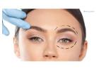 Eyelid Surgery in Islamabad