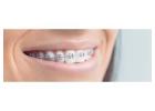 Gibb Orthodontics Offering Orthodontic Treatment Adults with Modern Care