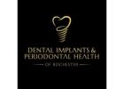 Dental Implants & Periodontal Health