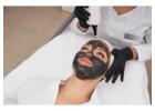 Hollywood Carbon Peel in Delhi – Radiant, Clear, and Refined Skin