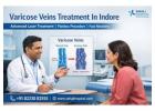 Varicose Veins Treatment In Indore - Sahaj Hospital