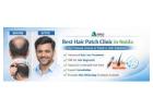 Best Hair Patch Clinic in Noida - Apolo Hair Studio Hair & Skin Care