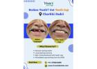 Teeth Cap Treatment in Charkhi Dadri | Triveni Dental