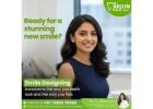 SmileDesign Treatment in Manikonda
