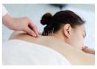 Professional Acupuncture Treatment London Restore Balance Relieve Pain Naturally