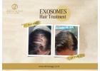 Hair Exosome Therapy for Regrowth in Indore Clinics