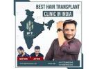best hair transplant clinic in Jaipur