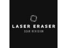 Laser Surgical Scar Removal For Smooth Clear Skin
