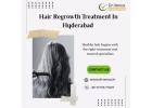 Best Hair Specialist In Hyderabad | Dr. Venus