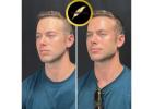 Aesthetic & Cosmetic Surgeon in Los Angeles | Dr. Saurabh Jain