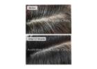 Real Care with Natural Scalp Treatment That Supports Healthy Hair